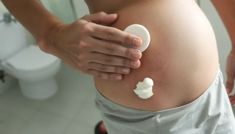 Cuisses qui frottent : 7 solutions efficaces pour éviter et soulager les irritations